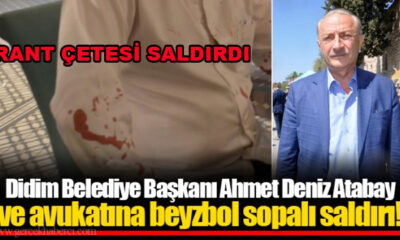 Didim Belediye Başkanı Ahmet Deniz Atabay saldırıya uğradı