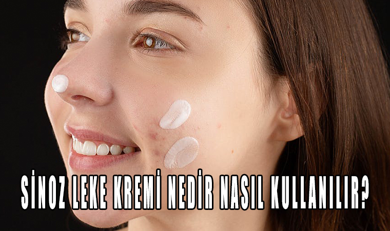 Sinoz Leke Kremi Nedir Nasıl Kullanılır?