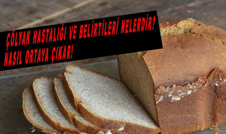 Çölyak hastalığı ve belirtileri nelerdir nasıl ortaya çıkar!