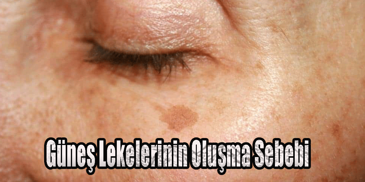 Güneş Lekelerinin Oluşma Sebebi