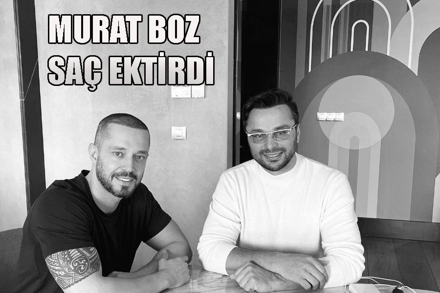 Murat Boz Saç Ektirdi, Saçları seyrelmiş