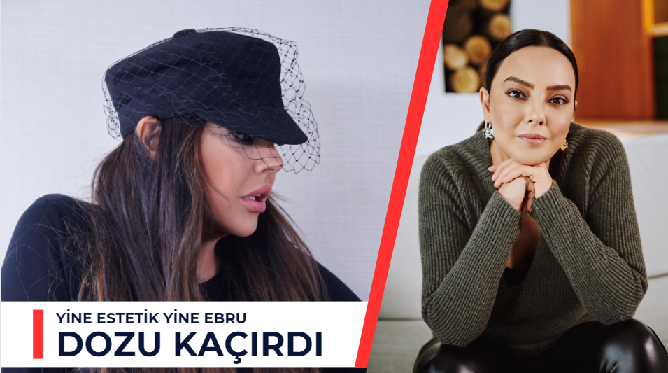 Ebru Gündeş Estetiğin Dozunu Kaçırdı