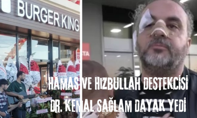 Hamas ve Hizbullah Destekçisi Dr. Kemal Sağlam Dayak Yedi